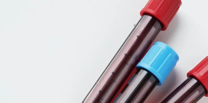 Ini Jenis Penyakit Darah Yang Anda MESTI Tahu Selain Anemia Dan Talasemia!