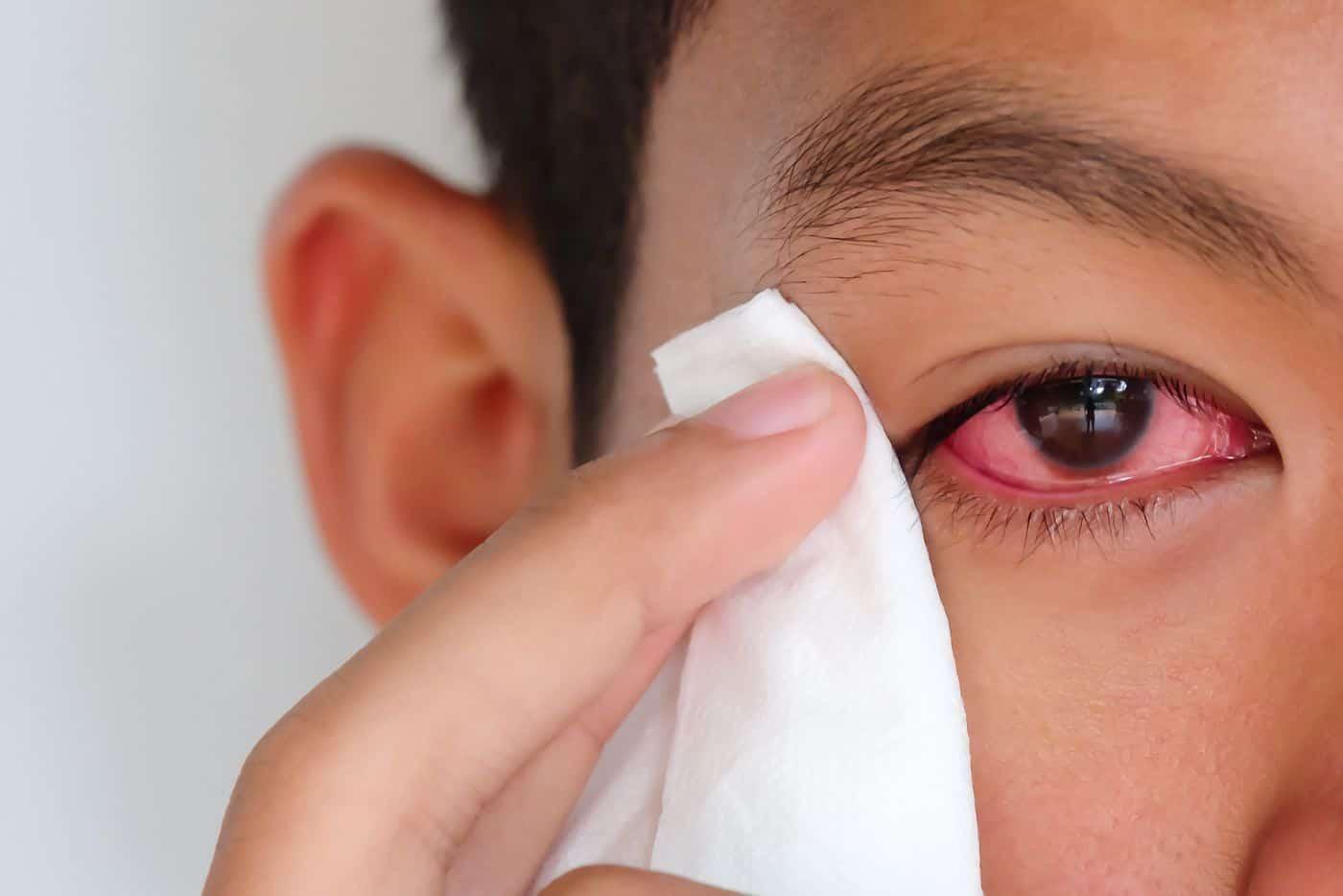 Ini 6 Cara Untuk Merawat Sakit Mata Dengan Betul, Jangan Biar Sampai Berlanjutan!