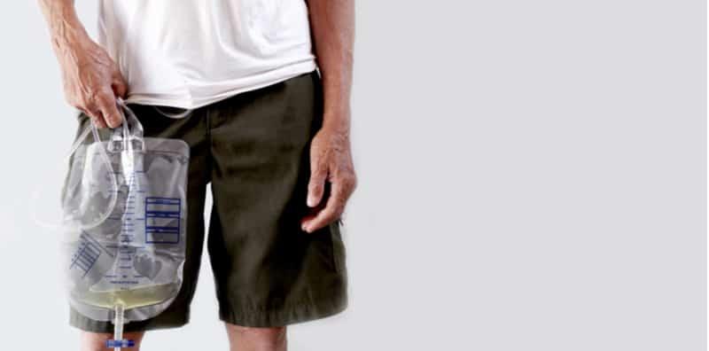 Masalah Prostat Membesar: Simptom, Punca & Rawatan Yang Boleh Dilakukan Kaum Adam!