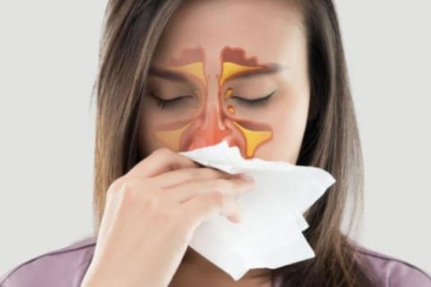 Hidung Tersumbat Tak Henti? Mungkin Puncanya Salah Satu Dari 3 Masalah Ini!