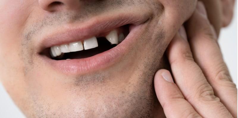 Tahukah Anda, Penghidap Diabetes Sebenarnya Berisiko Alami Gigi Tercabut, Ini Sebabnya!