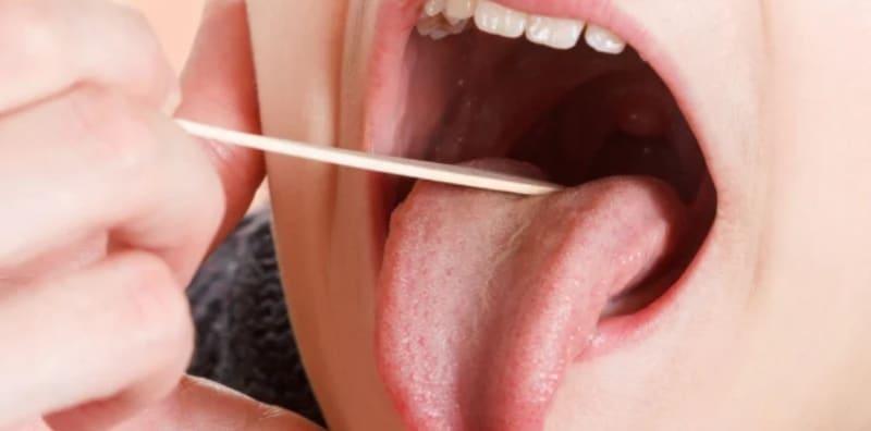 Sakit Tekak Tapi Tak Tahu Apa Puncanya, Ini Dia 4 Jenis Penyakit Yang Lazim Berlaku!