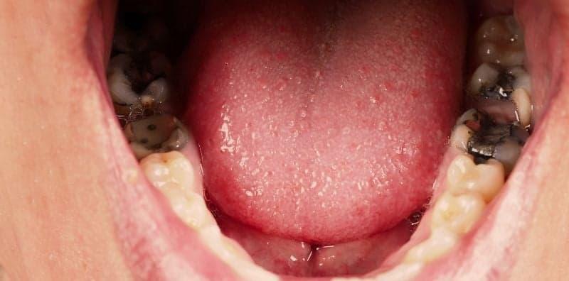 Jangan Abaikan Kesihatan Gigi! Ini 8 Masalah Ortodontik Yang Lazim Berlaku