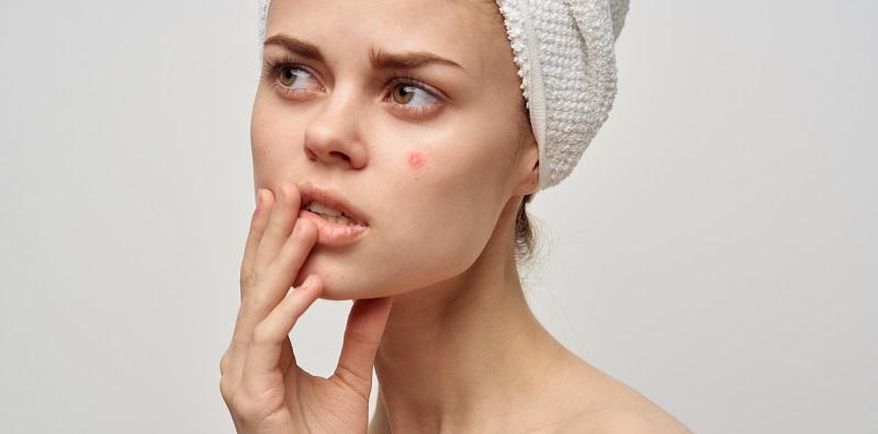 Jerawat Selalu Muncul Di Pipi? Cuba Ingat Balik, Ada Tak Anda Buat Perkara Ini?