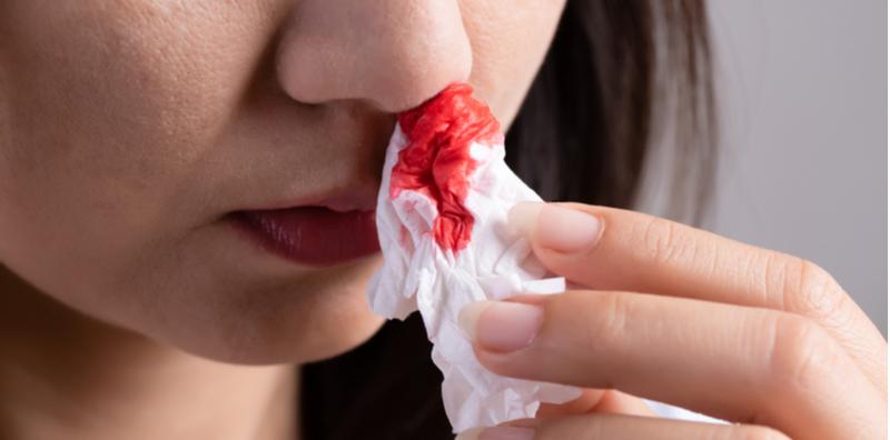 Najis Warna Hitam? Betul Ke Ni Sebab Tertelan Darah Yang Terkeluar Dari Hidung?