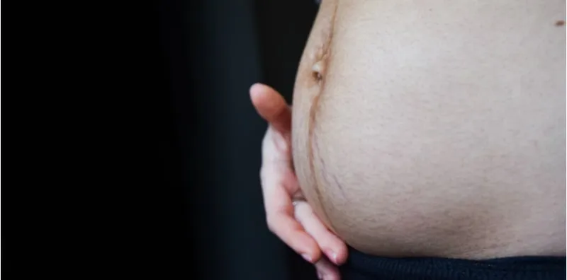 Banyak Komplikasi Jika Ibu Hamil Ada Diabetes, Paling Ekstrem Bayi Mati Dalam Perut