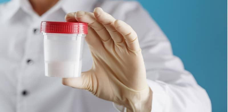 9 Kriteria Yang Dilihat Dalam Ujian Air Mani, Apa Persediaan Yang Perlu Saya Buat?