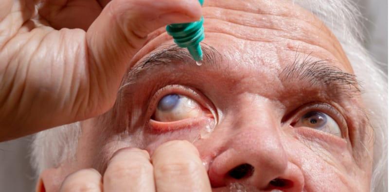 Tak Perlu Lagi Pembedahan Untuk Rawat Katarak! Ubat Titis Mata Sudah Cukup?