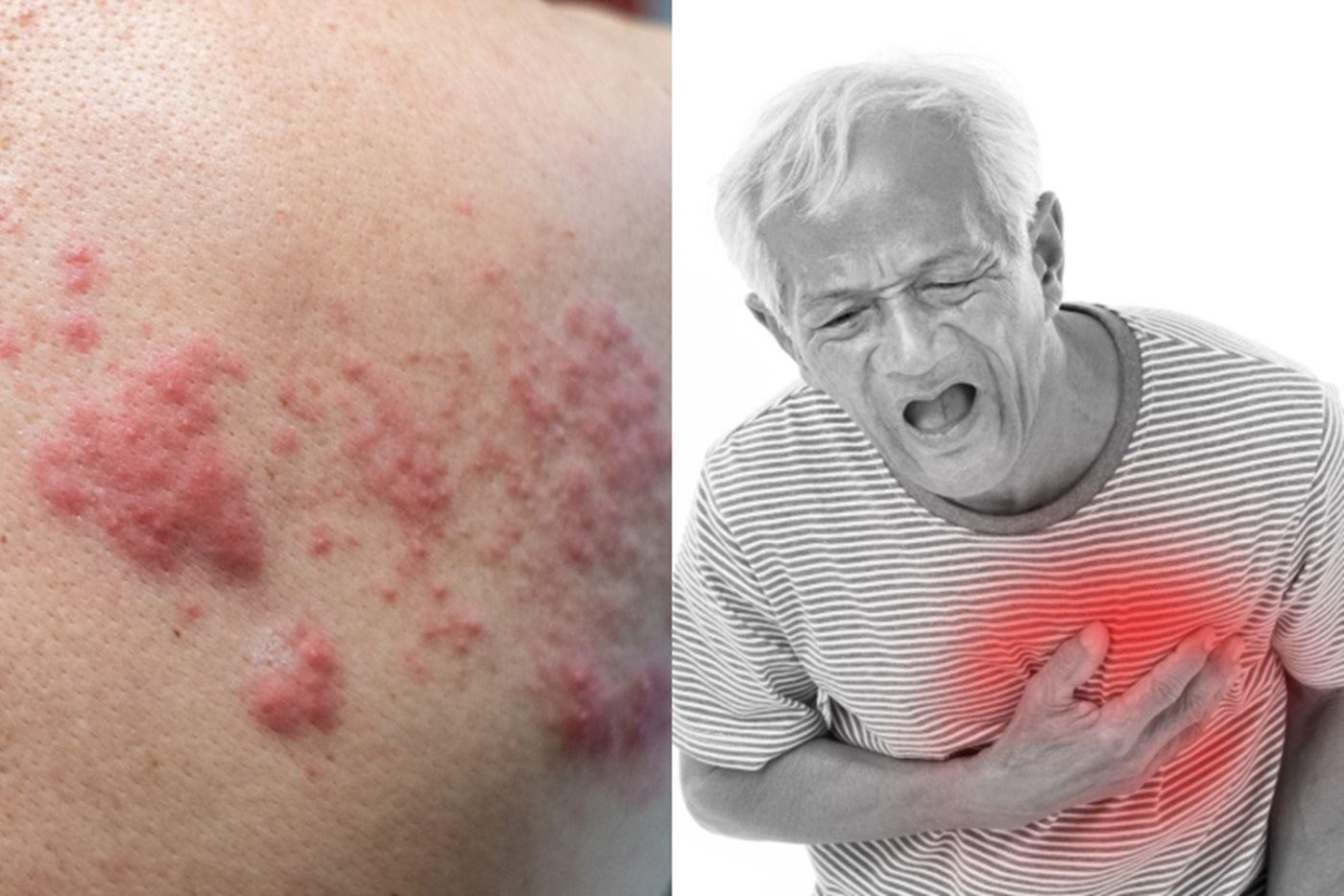 Bukan Setakat Kayap, Tapi Orang Tua Anda Juga Mudah Dapat 5 Jangkitan Ini!