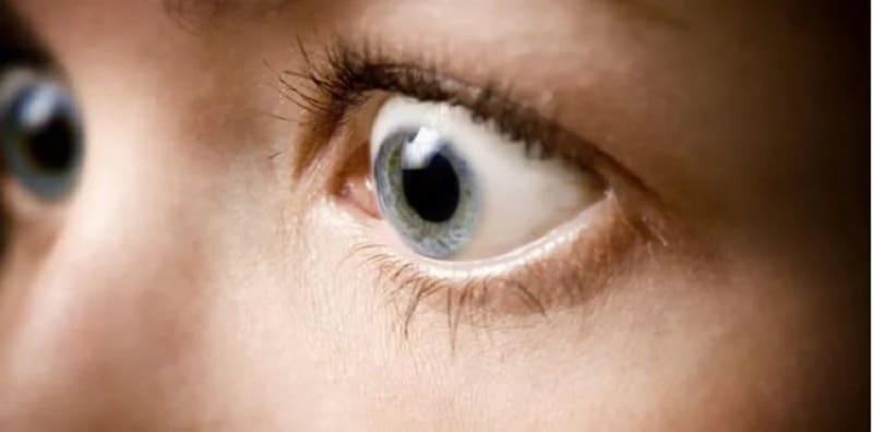 Mata Tiba-tiba Tersembul? Usah Biarkan! Ini Mungkin Petanda Masalah Mata Kronik