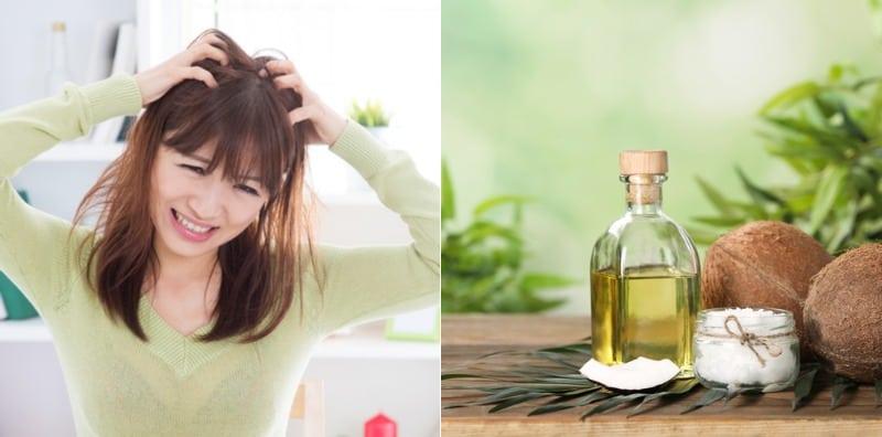 Rimasnya Bila Kulit Kepala Gatal, Ada 5 Bahan Semula Jadi Boleh Bantu Rawat!