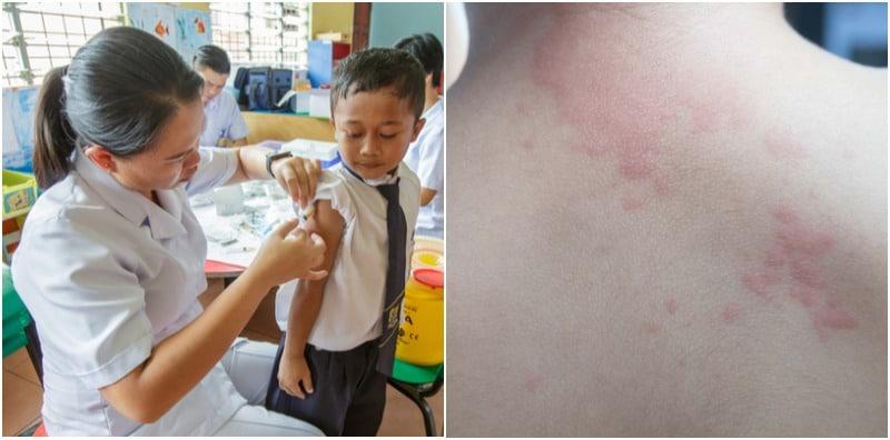 Tak Mahu Vaksinkan Anak? Parents Jangan Menyesal Jika Jadi 3 Benda Ini!