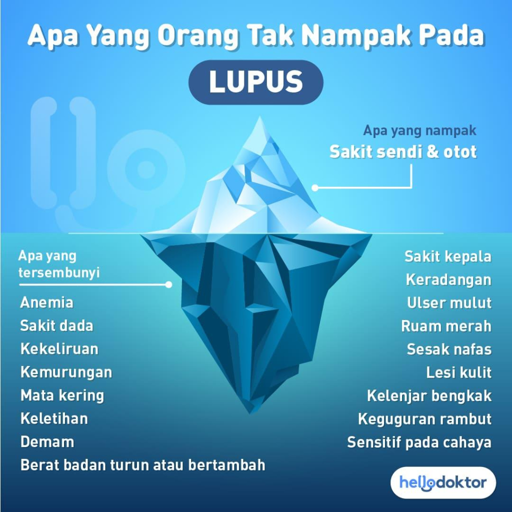 penyakit lupus