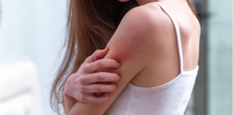 Awas, Kulit Gatal Simptom Penyakit Hati KRONIK! Atasinya Dengan 5 Tip Ini!