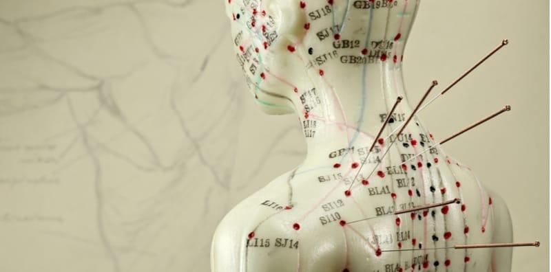 Rawatan Jarum Kering VS Akupuntur, Mana Satu Pilihan Terbaik Buat Anda?