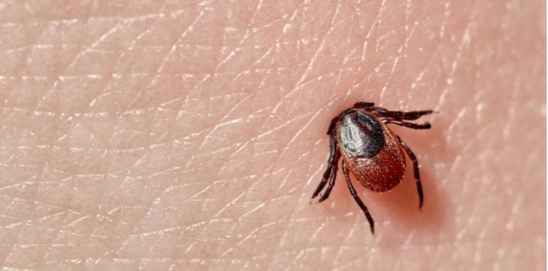 Anda Kena Buang Kutu Dalam Tempoh 48 Jam Bila Digigit, Elak Penyakit Lyme!