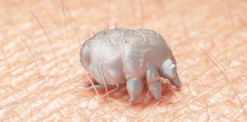 Kenali 3 Serangga Yang Boleh Hidup Di Bawah Kulit Manusia! No. 3 Paling Ngeri & BAHAYA!