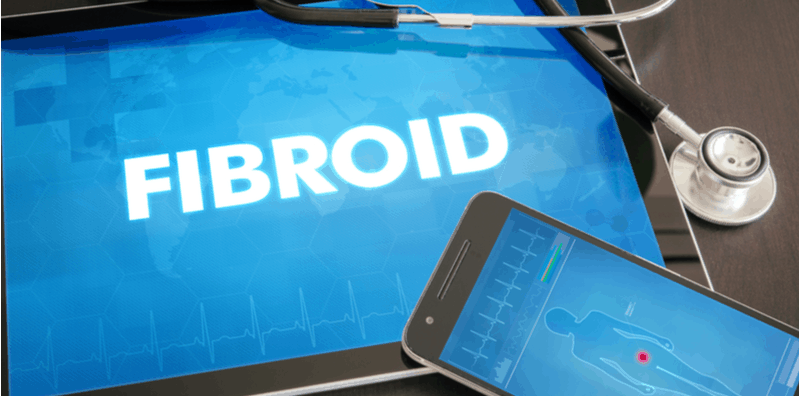 Menarik! Ada Cara Nak Rawat Fibroid Tanpa Bedah, Boleh Tingkatkan Rangsangan Seks Juga!