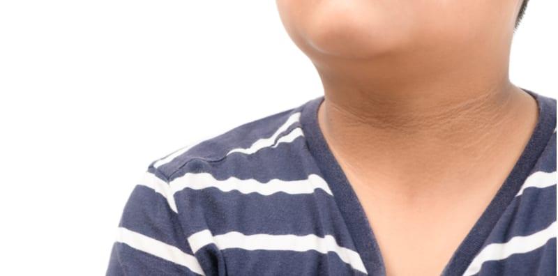 Jaga-jaga! Kalau Kulit Jadi Hitam & Tebal, Anda Mungkin Alami Keadaan Kulit Ini...