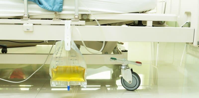 Pernah Tengok Orang Pakai Tiub Untuk Kencing? Fahami Fungsi Kateter Urin Buat Pesakit Sukar Buang Air Kecil