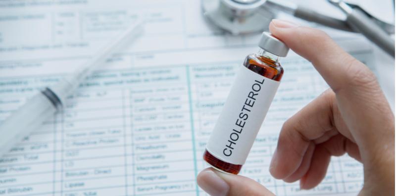 Ada Sebab Mengapa Anda Perlu Tahu Tahap Kolesterol, Jika Tidak Berisiko Pada Otak!