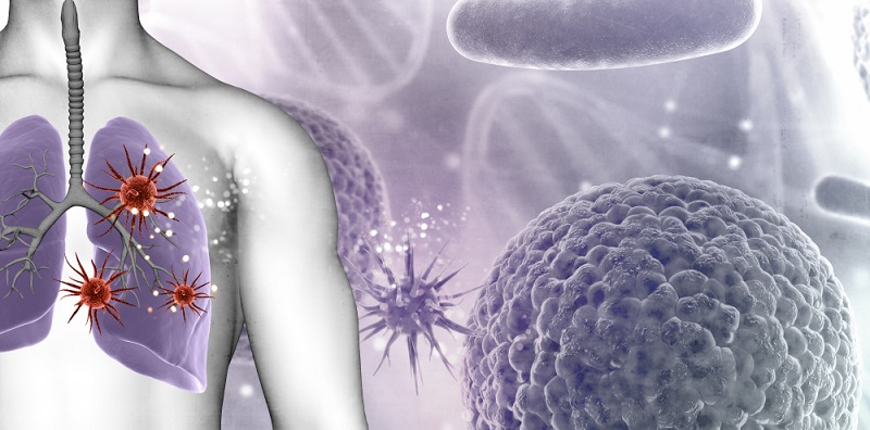 Nak Kurangkan Risiko Kanser Paru-Paru? Mudah Sahaja, Ikuti 10 Langkah Ini!