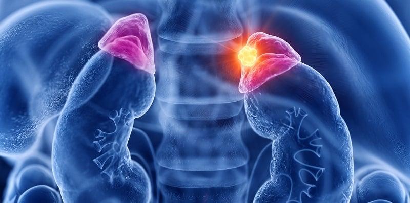 Ada Bonggol Belakang Leher Petanda Sindrom Cushing, Puncanya Terlalu Banyak Hormon Steroid Dalam Badan!