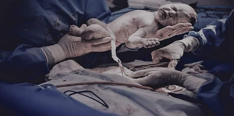 Ada Manfaat Jika Simpan Darah Tali Pusat Bayi, Tapi Bolehkah Bagi Yang Beragama Islam?