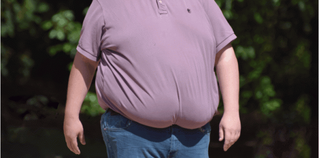 Kalau BMI Anda Lebih 35, Itu Tanda Obesiti Morbid, Ada Risiko Dapat 9 Jenis Penyakit Ini!