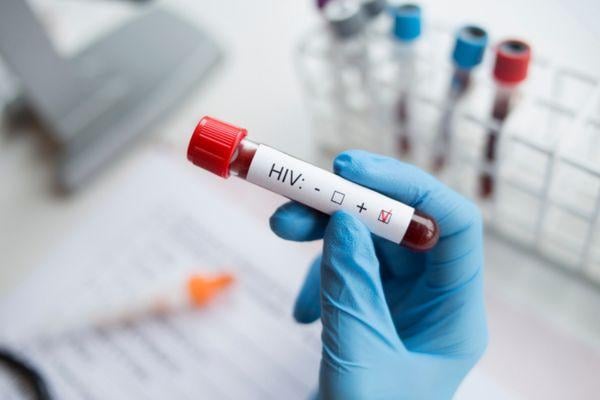 tanda hiv pada kulit
