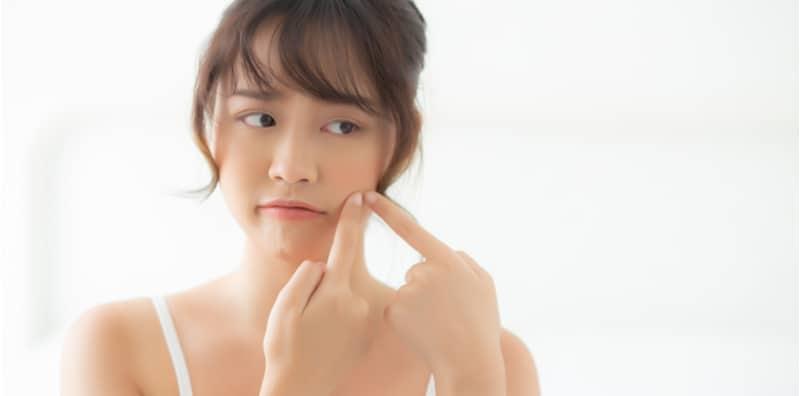 Jatuh Cinta Membawa Bahagia, Tapi Juga Mengundang Jerawat? Mitos Atau Fakta?