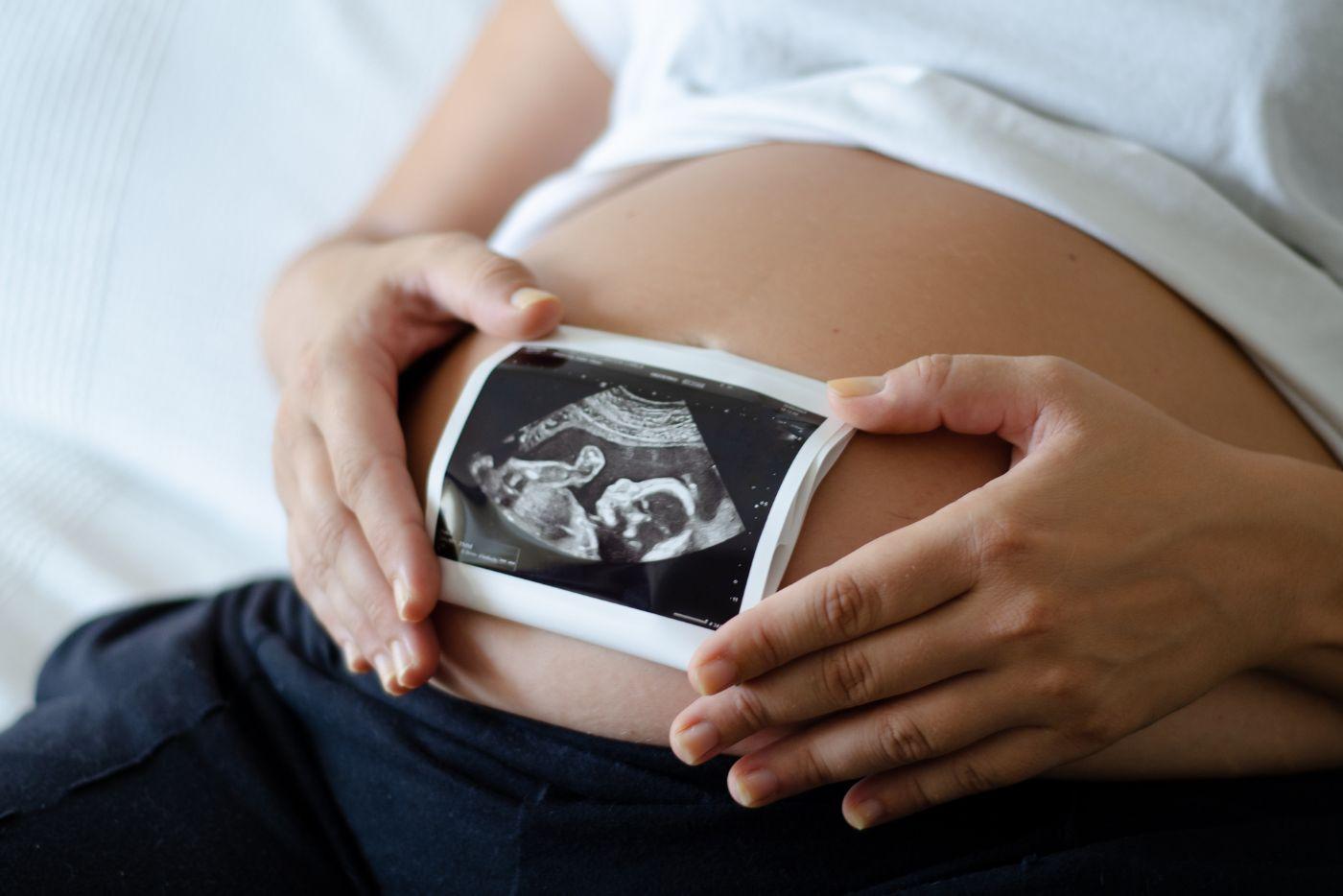 Ibu Hamil Tak Sabar Nak Scan Baby? Ini Yang Akan Berlaku Semasa Imbasan!