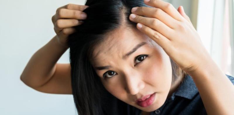 Kesan Diabetes Pada Tubuh Boleh Buat Rambut Gugur? Jaga-jaga!