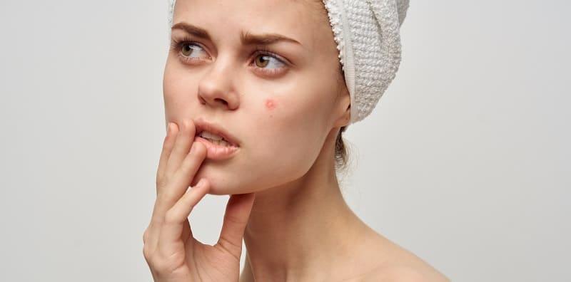 Tak Boleh Lebih 3x Basuh Wajah? Ini Cara Cuci Muka Berjerawat Yang Betul