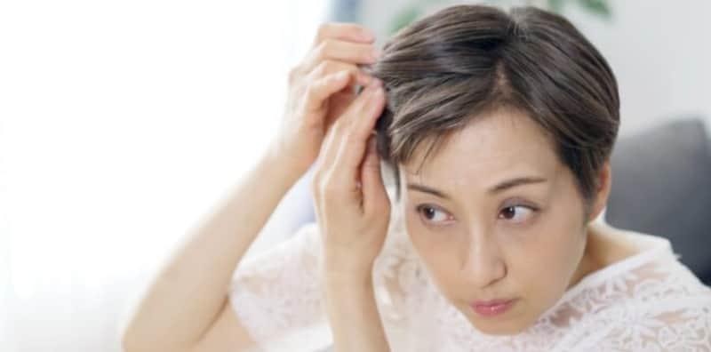 Rambut Gugur Teruk Sampai Botak Angkara Diabetes? Ini 3 Penyebabnya