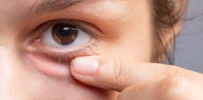 Bahaya Tak Kawal Diabetes, Anda Boleh Kena Retinopati Diabetik Atau Buta Kalau Makin Teruk!