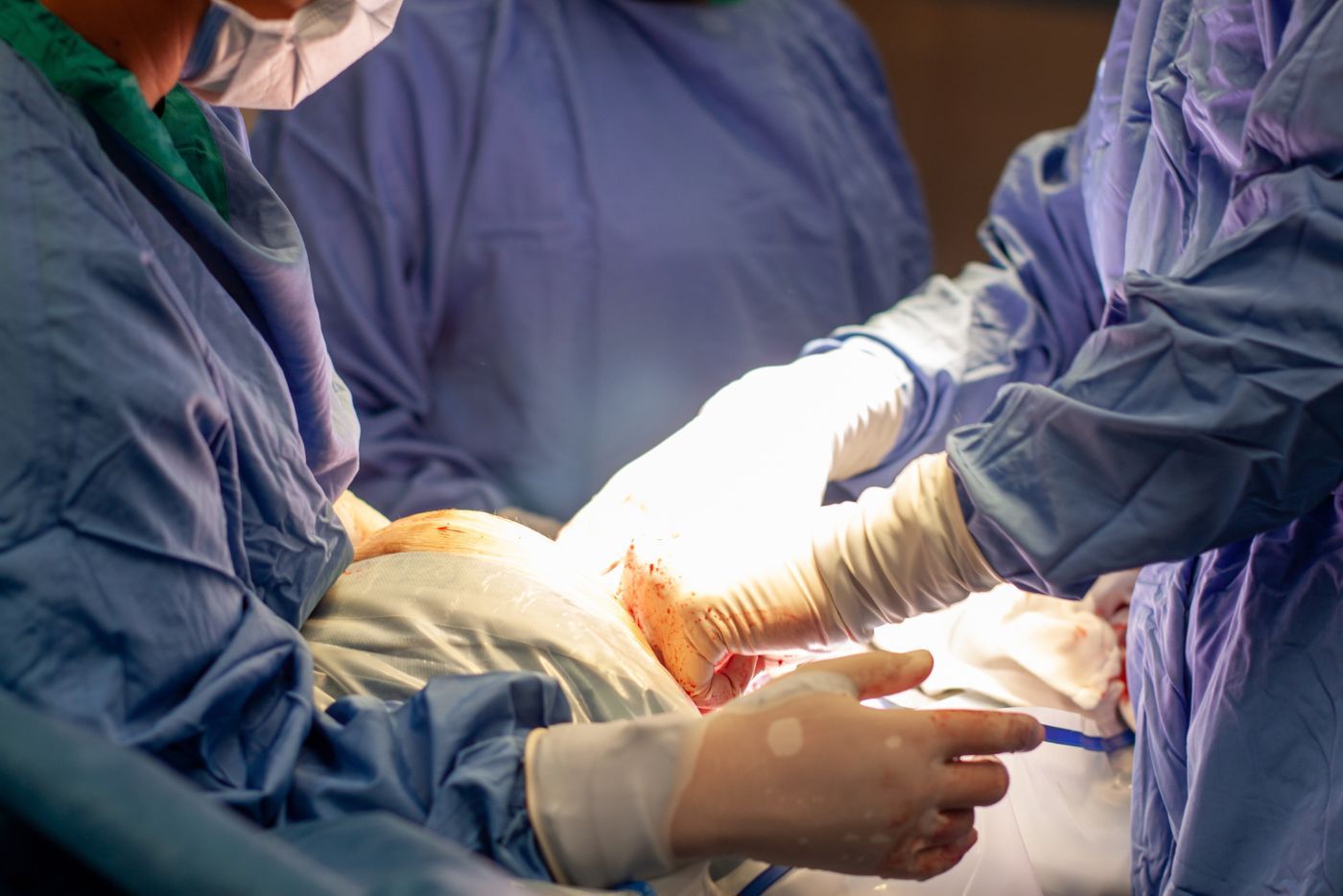 Jaga Percakapan! In 8 Kesan Pada Emosi Ibu Bersalin Secara Pembedahan