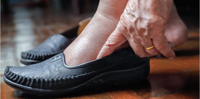 Ada Kasut Khas Untuk Pesakit Diabetes, Perlu Ke Pakai? Ini Penjelasannya...