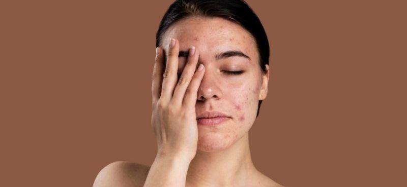 Kulit Kering Dan Mengelupas? Ia Mungkin Angkara Aircond Di Rumah Anda!