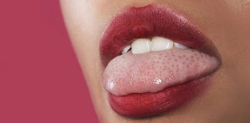 Warna Lidah Normal Merah Jambu? Ini Cara Nak Tahu Kesihatan Lidah
