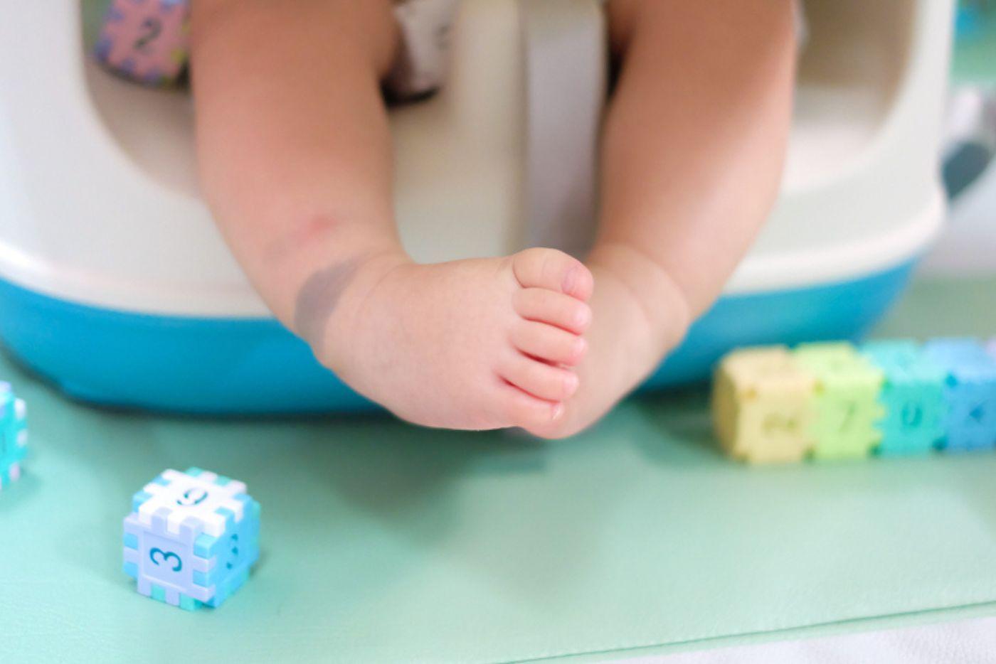 tanda-lahir-pada-bayi