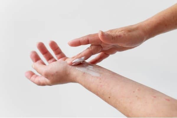 sabun mandi untuk psoriasis