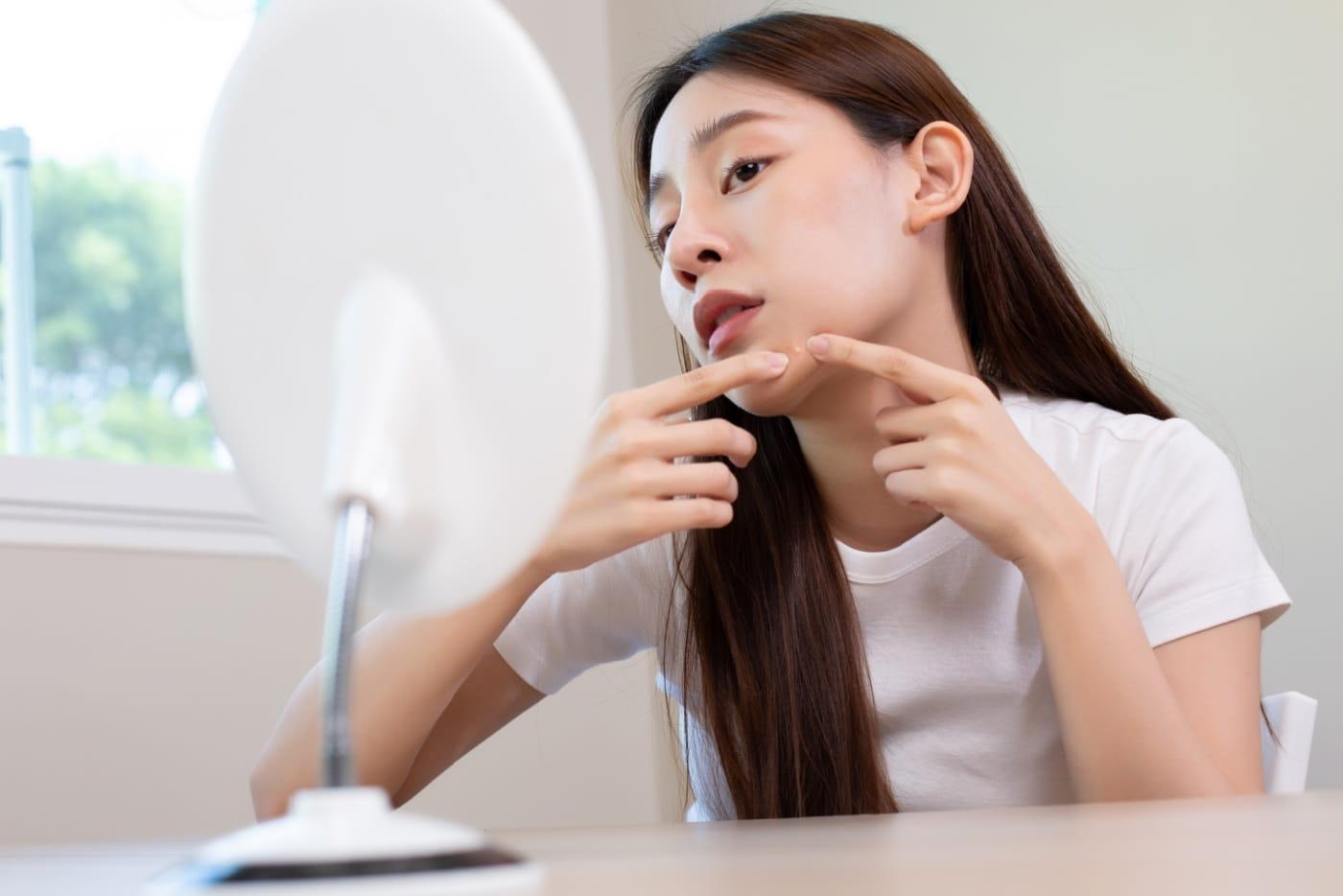 5 Kebaikan Probiotik Untuk Kulit, Salah Satunya Boleh Buat Awet Muda!