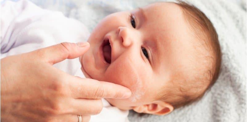 Kulit Anak Naik Ekzema? Cuba 5 Produk Popular Baik Untuk Kulit Baby Eczema