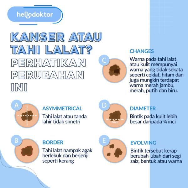 tanda lahir coklat