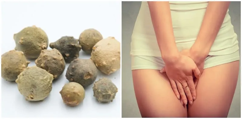 Wanita Kena Ambil Manjakani Sebab Ia Bagus Untuk Faraj? Ini 7 Manfaatnya!