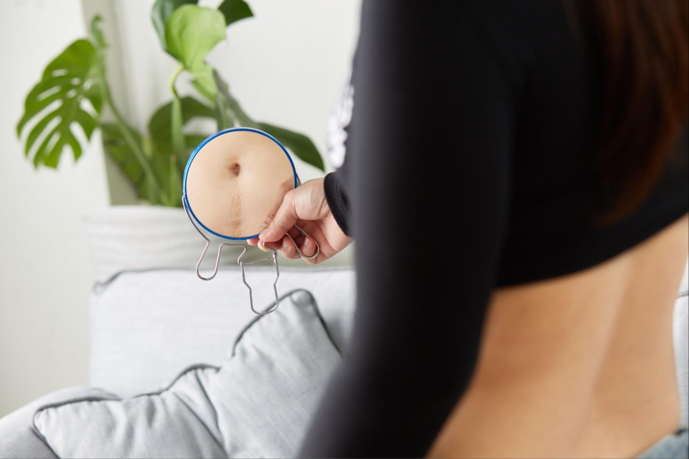 4 Punca Luka Czer Boleh Terbuka Semula, Ibu Baru Bersalin Perlu Ambil Tahu!