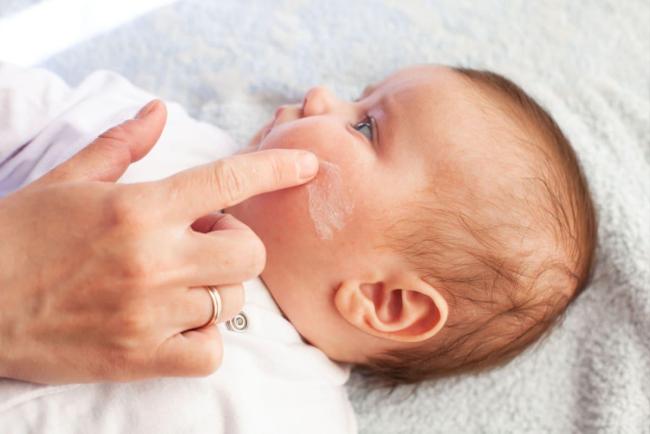 Kulit Baby Kering & Gatal? Ini 7 Produk Trending 2026 Untuk Ekzema Anak