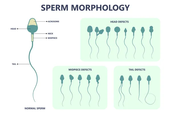 struktur sperma