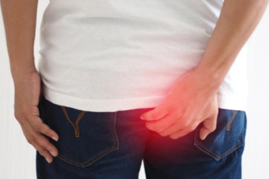 Petua Kecutkan Buasir Yang Popular, Sapu Minyak Gamat, Berkesan Ke?